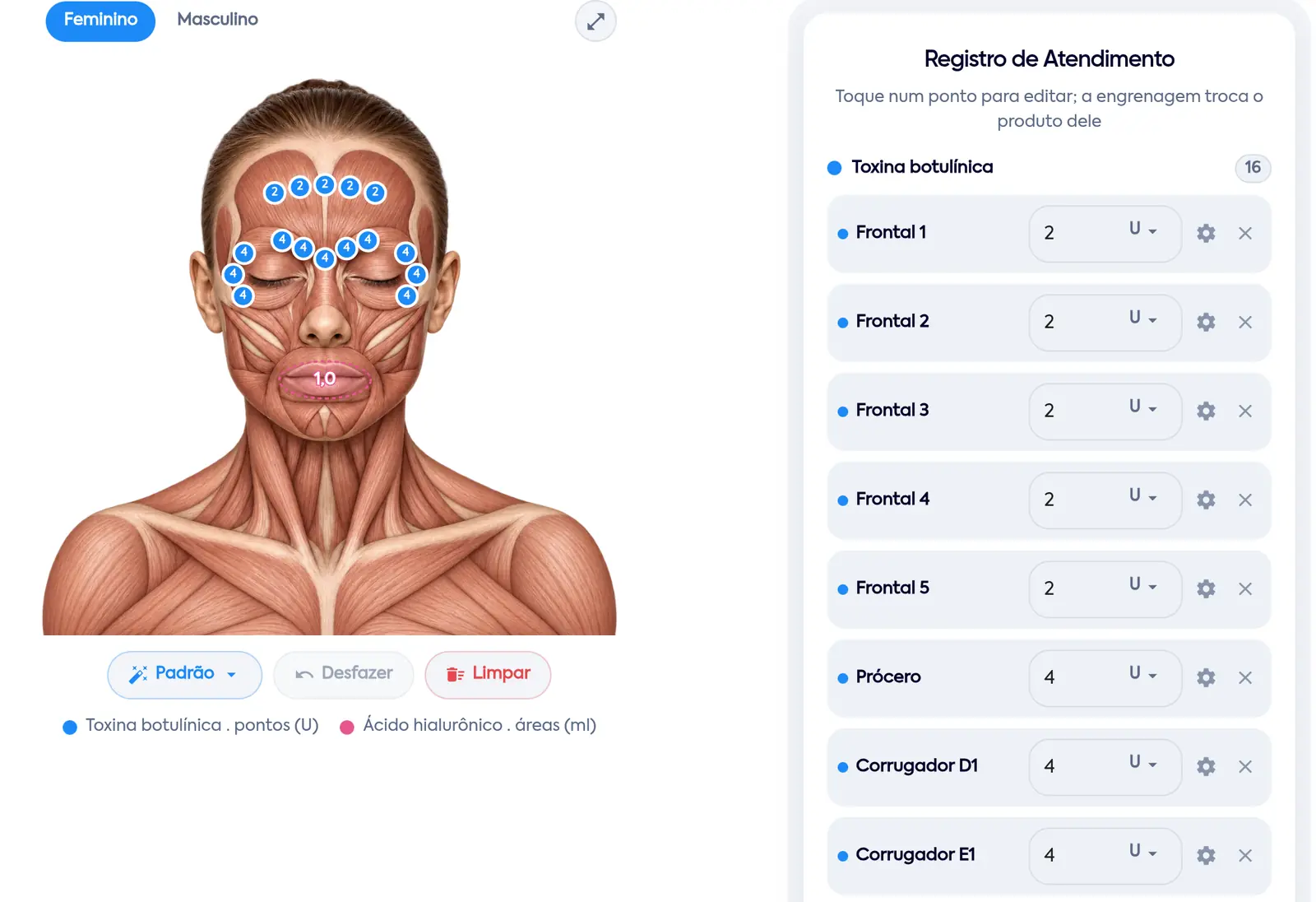 Mapa facial do WCare no desenho feminino: pontos de toxina com as unidades dentro, a área de preenchedor nos lábios em ml e o Registro de Atendimento com a dose de cada ponto